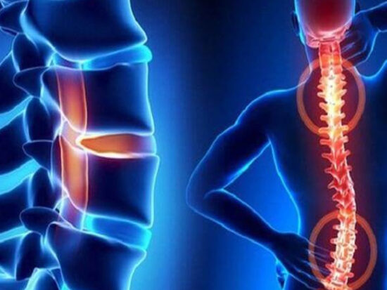 Thoái-hóa-cột-sống Thoái-hóa-cột-sống