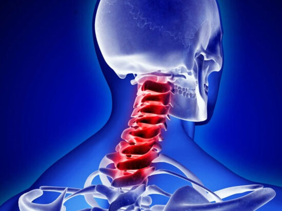 Thoát-vị-đĩa-đệm-đốt-sống-cổ Thoát-vị-đĩa-đệm-đốt-sống-cổ